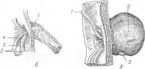 Хирургия грыж брюшной стенки - any2fbimgloader35.jpeg