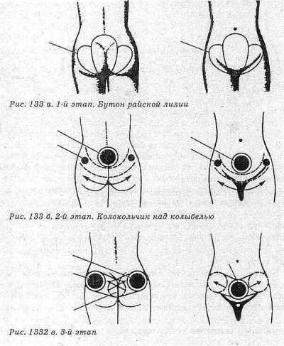 Система здоровья Норбекова и Сам Чон До. Полный курс - hvan_133.jpg