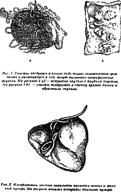 Жизнь без паразитов - i01.png