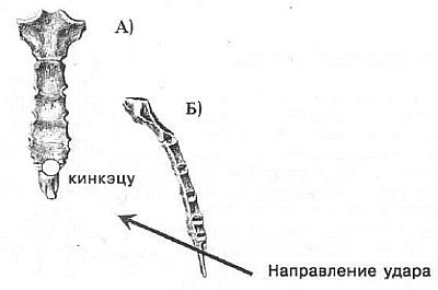 Aнатомия жизни и смерти. Жизненно важные точки на теле человека - _128.jpg