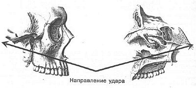 Aнатомия жизни и смерти. Жизненно важные точки на теле человека - _88.jpg