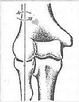 Aнатомия жизни и смерти. Жизненно важные точки на теле человека - _9.jpg