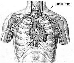 Aнатомия жизни и смерти. Жизненно важные точки на теле человека - _138.jpg