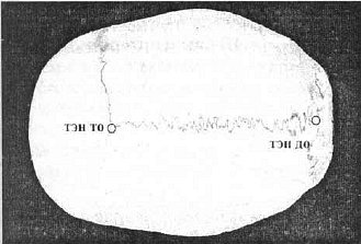 Aнатомия жизни и смерти. Жизненно важные точки на теле человека - _81.jpg