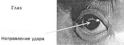 Aнатомия жизни и смерти. Жизненно важные точки на теле человека - _97.jpg