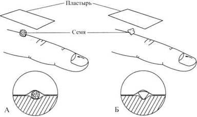 Су Джок семянотерапия - any2fbimgloader33.jpeg