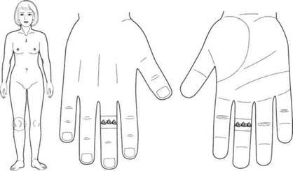 Су Джок семянотерапия - any2fbimgloader147.jpeg