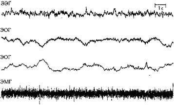 Как избавиться от бессонницы - any2fbimgloader0.jpeg