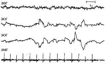 Как избавиться от бессонницы - any2fbimgloader1.jpeg
