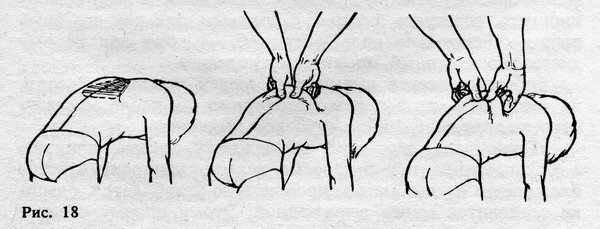 Физкультурный заслон ОРЗ - ris_18.jpg