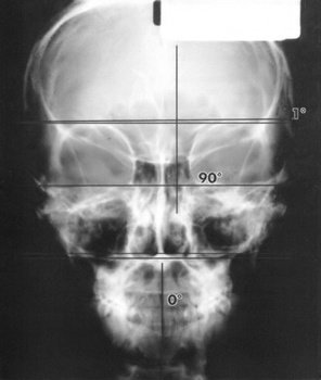 Квантовое Прикосновение: Исцеляющая энергия - i_043.jpg