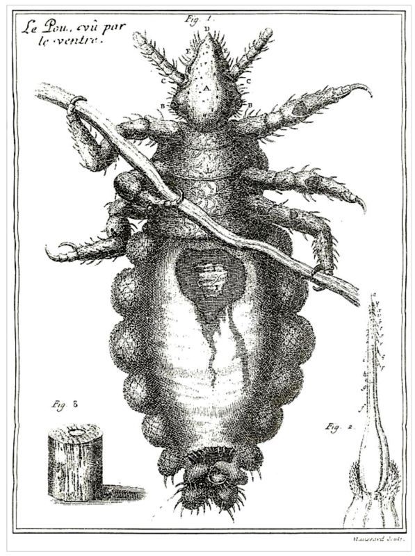 Описание вши, виденной в микроскоп - i_005.jpg